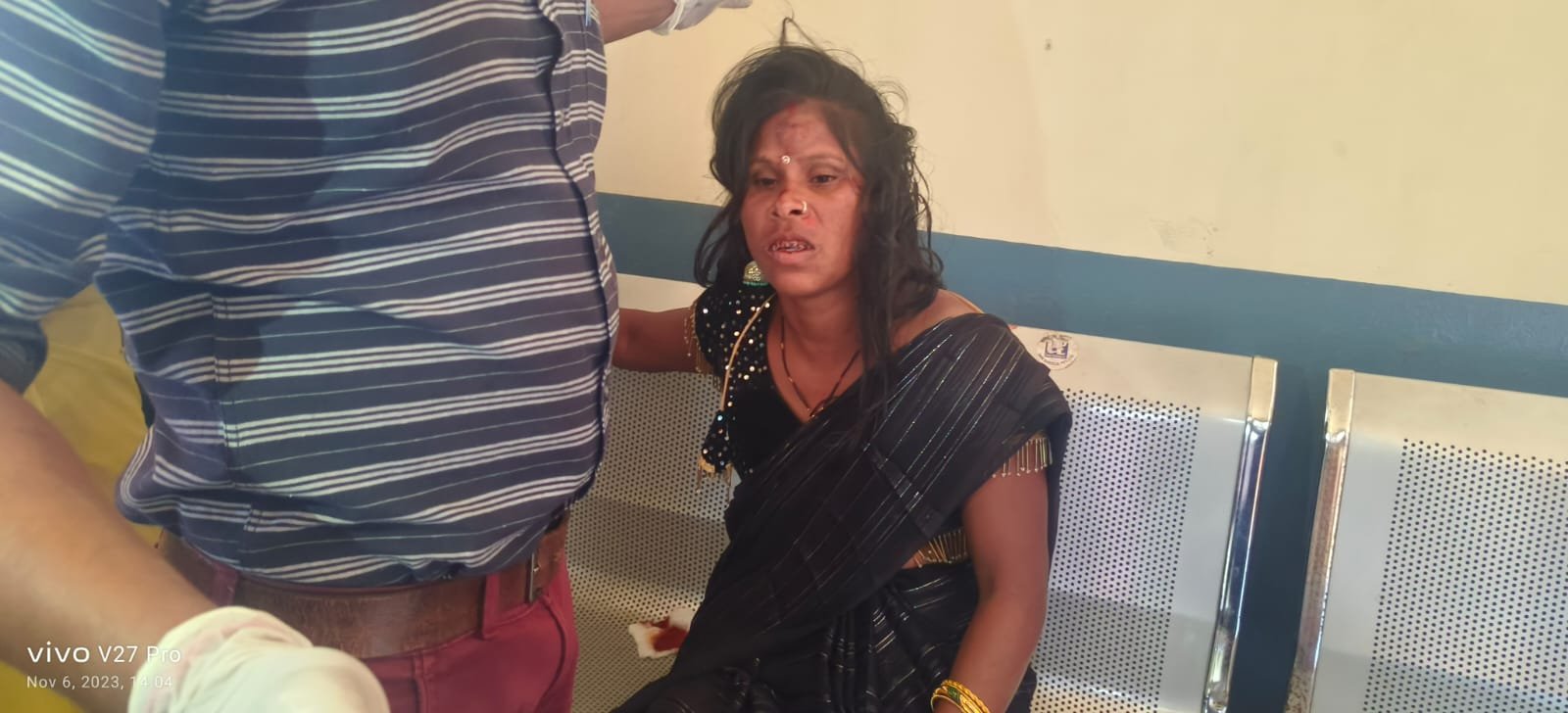मोटरसाइकिल दुर्घटना में तीन घायल,इलाज जारी मोटरसाइकिल दुर्घटना में तीन घायल,इलाज जारी