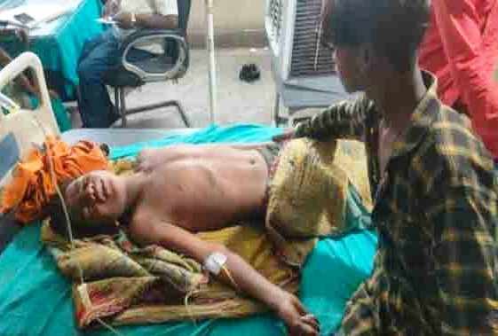 आकाशीय बिजली की चपेट में आकर किशोर झुलसा, रिम्स रेफर