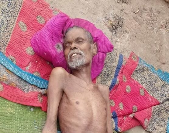 लंबे समय से कुष्ठ रोग से जूझ रहे तपेश्वर सिंह ने लिया अंतिम सांस