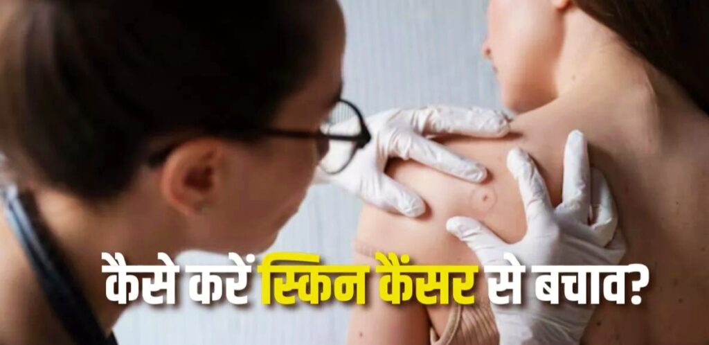 Skin Cancer Se Bachne Ke Liye Sirf Sunscreen Lagana Kafi Nahi Hai, In 7 Baato Ka Dhyan Rakhein Skin Cancer Se Bachne Ke Liye Sirf Sunscreen Lagana Kafi Nahi Hai, In 7 Baato Ka Dhyan Rakhein