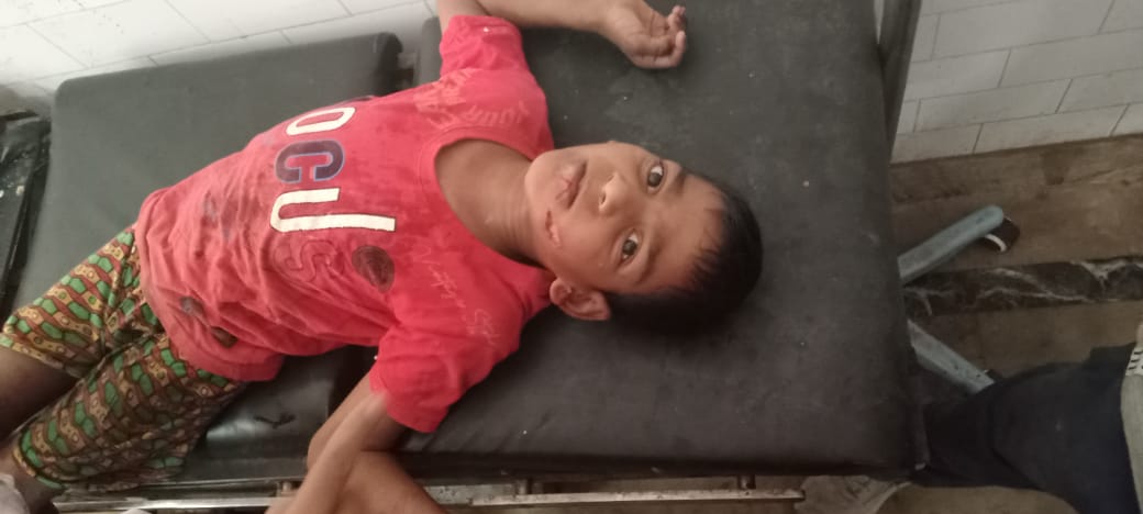 आवारा कुत्ते के हमले में आठ वर्षीय बच्चा घायल, सदर अस्पताल में भर्ती