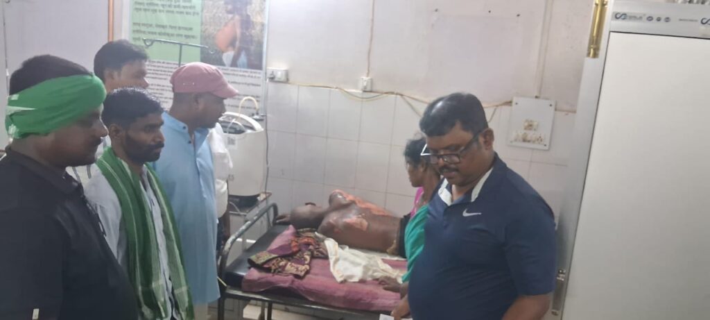 चावल का गर्म पानी (माड़)से झुलसा व्यक्ति,रेफर चावल का गर्म पानी (माड़)से झुलसा व्यक्ति,रेफर