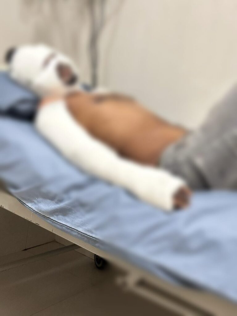 करंट लगने से झुलसा बिजली विभाग का दैनिक वेतनभोगी,रांची में भर्ती करंट लगने से झुलसा बिजली विभाग का दैनिक वेतनभोगी,रांची में भर्ती