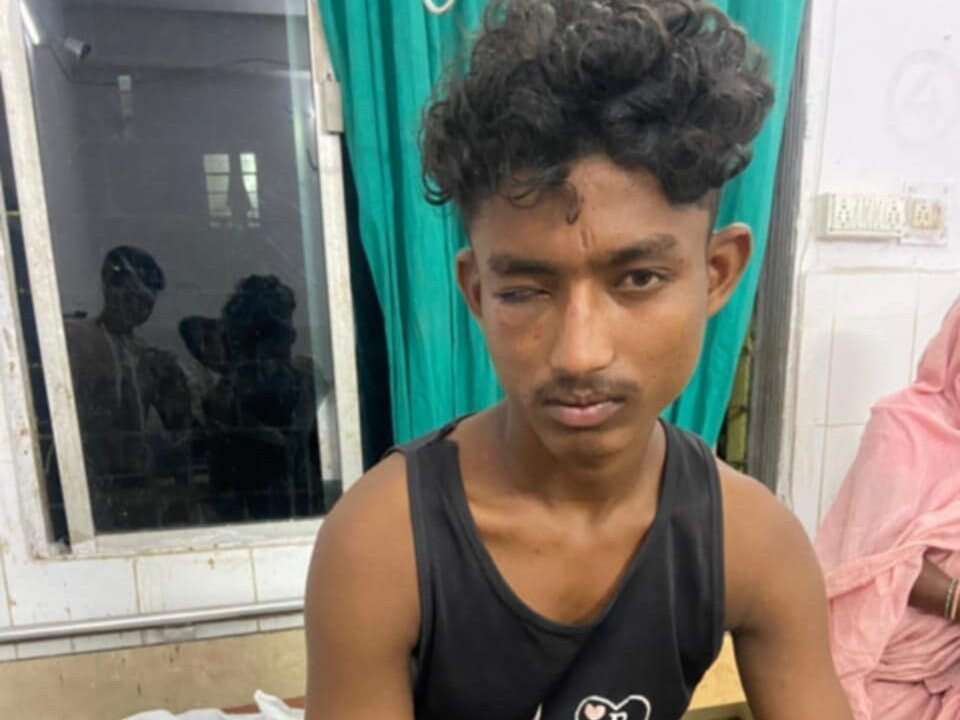 मारपीट में युवक की आंख जख्मी, शिकायत दर्ज मारपीट में युवक की आंख जख्मी, शिकायत दर्ज