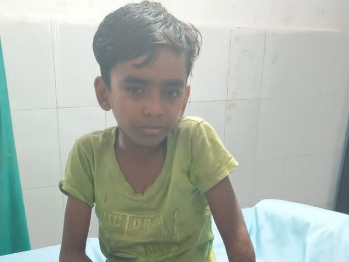 सियार के काटने से दस वर्षीय बालक घायल