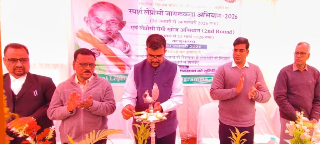 महात्मा गांधी की पुण्यतिथि पर सदर अस्पताल लातेहार से ‘स्पर्श कुष्ठ जागरूकता अभियान’ का शुभारंभ महात्मा गांधी की पुण्यतिथि पर सदर अस्पताल लातेहार से ‘स्पर्श कुष्ठ जागरूकता अभियान’ का शुभारंभ