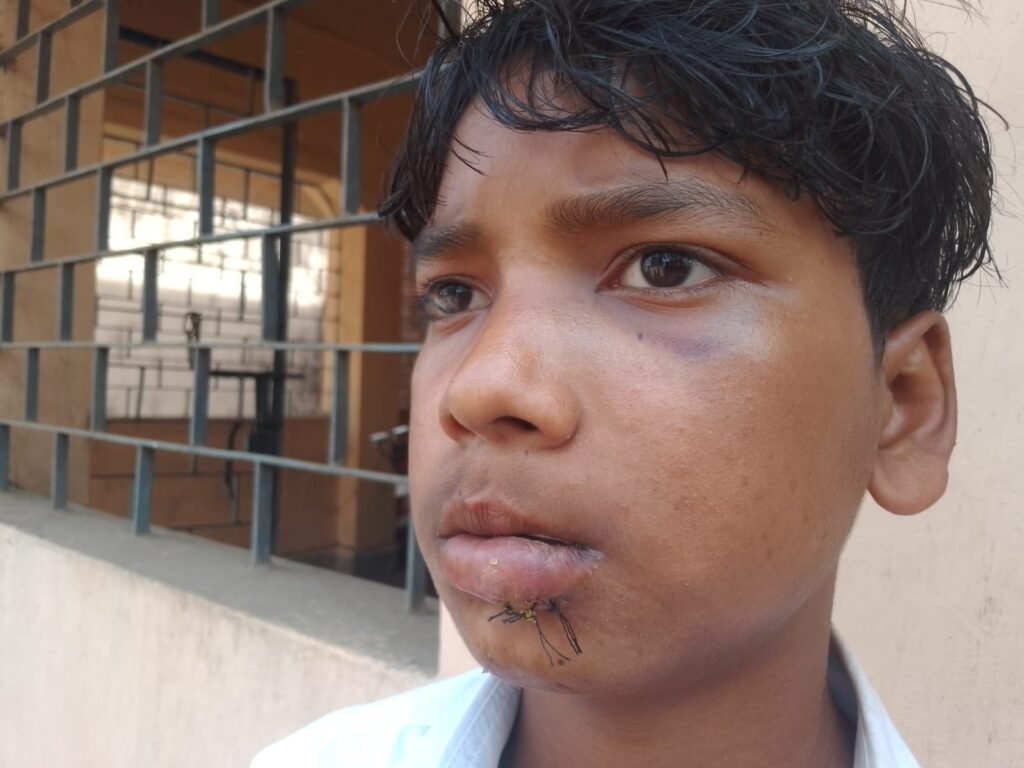 Latehar News:मनिका आवासीय विद्यालय के प्रधानाध्यापक पर छात्रों की पिटाई का आरोप, एक छात्र के होंठ पर लगे टांके — परिजनों में आक्रोश
