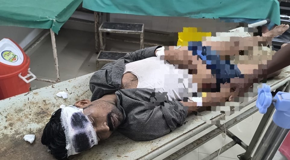ट्रेन छूटते देख दौड़ा यात्री, चढ़ने के प्रयास में गंभीर रूप से घायल ट्रेन छूटते देख दौड़ा यात्री, चढ़ने के प्रयास में गंभीर रूप से घायल