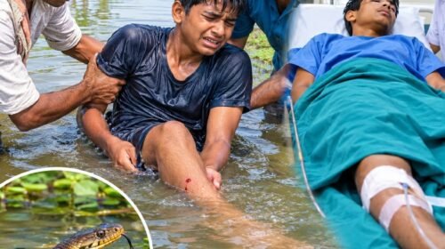 पटसन छुड़ाने के दौरान किशोर को सांप ने डंसा,अस्पताल में भर्ती
