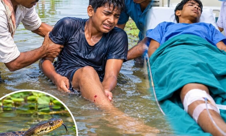 पटसन छुड़ाने के दौरान किशोर को सांप ने डंसा,अस्पताल में भर्ती पटसन छुड़ाने के दौरान किशोर को सांप ने डंसा,अस्पताल में भर्ती