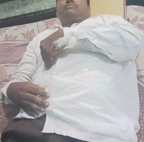 तेज रफ्तार स्कॉर्पियो ने बाइक सवार पशु चिकित्सक को मारी टक्कर, गंभीर हालत में पटना रेफर
