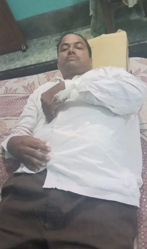 तेज रफ्तार स्कॉर्पियो ने बाइक सवार पशु चिकित्सक को मारी टक्कर, गंभीर हालत में पटना रेफर